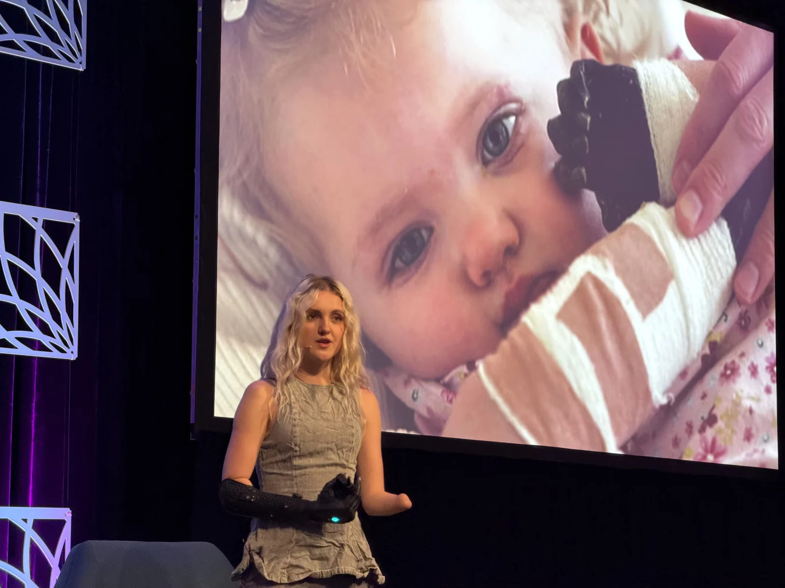 A woman with a prosthetic arm speaks on stage, a screen displays a baby with bandaged arms.