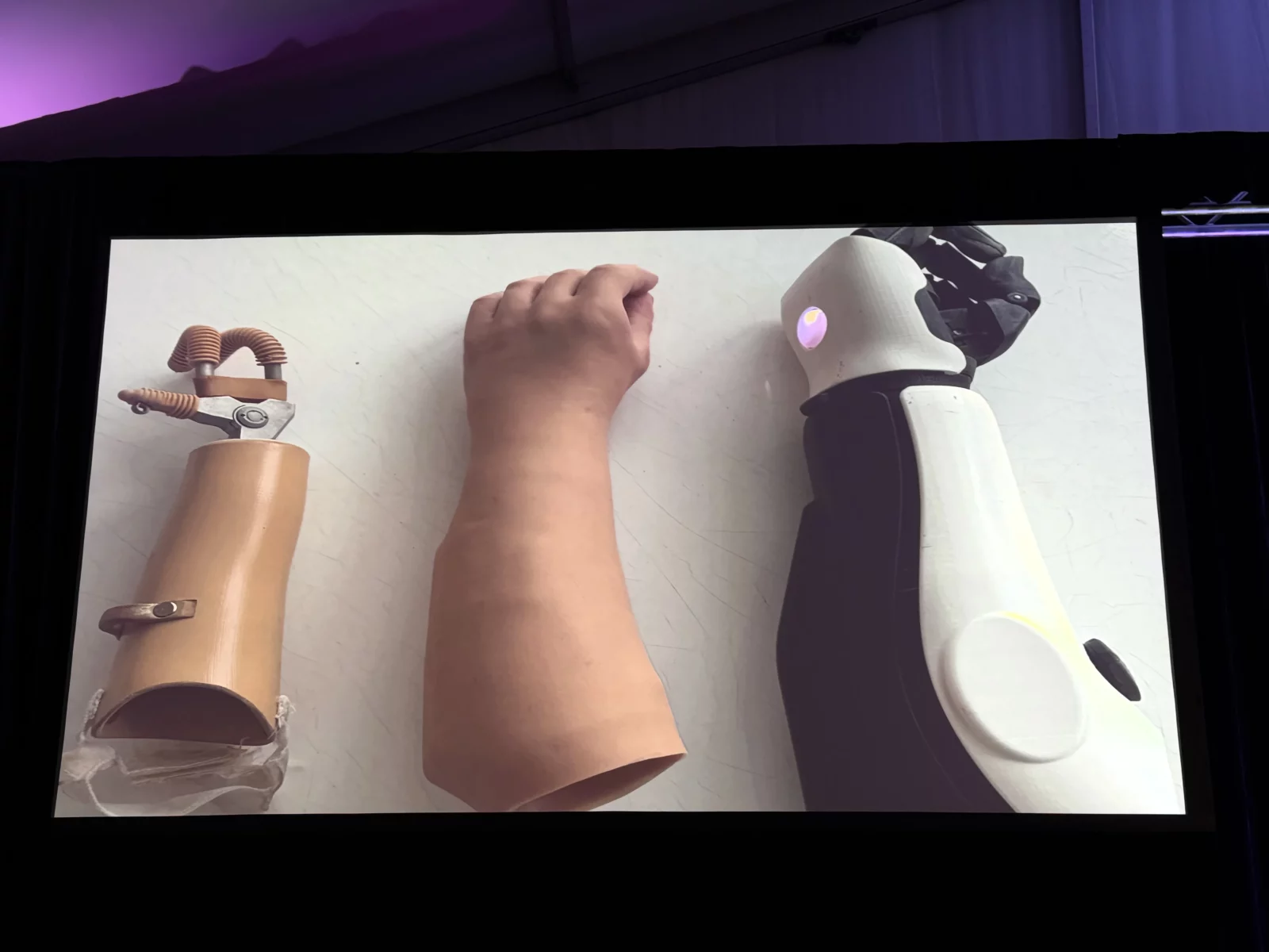 Three prosthetic arms, one hook, one realistic, and one bionic, are displayed on a screen.
